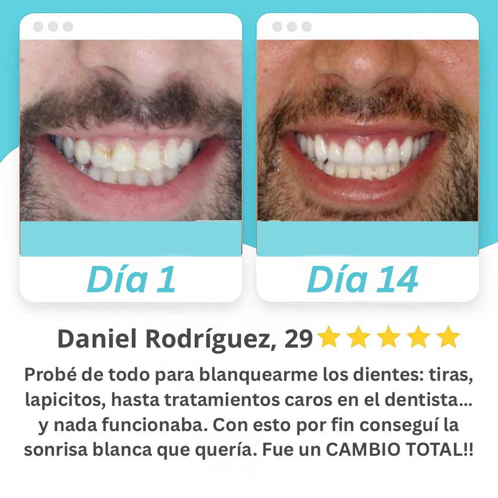 Cepillo De Dientes Eléctrico 360° Elysium™
