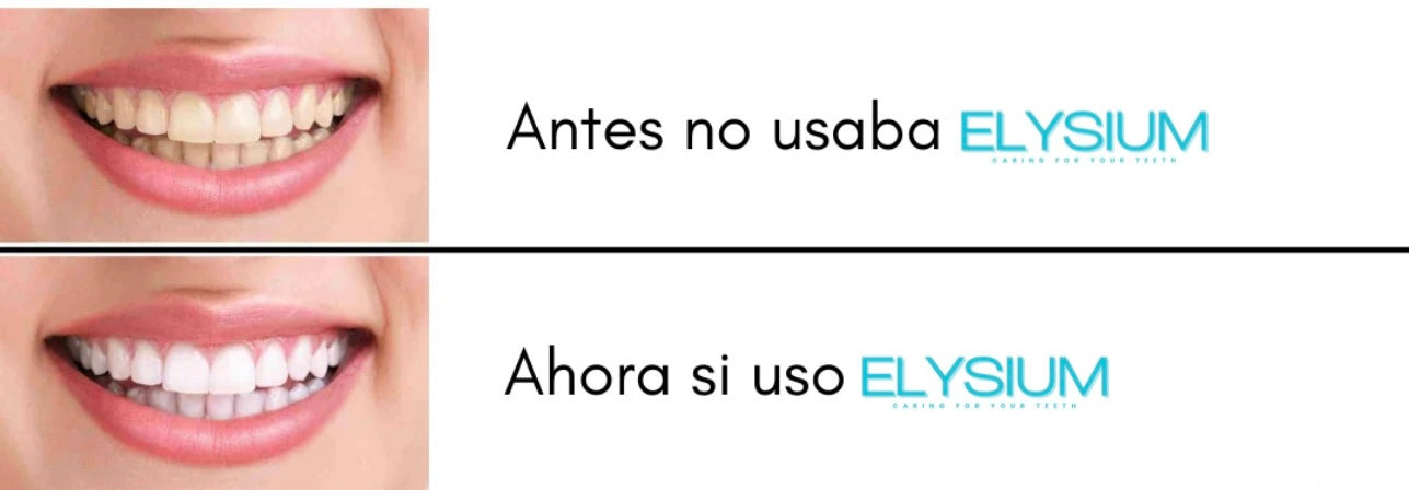 Cepillo De Dientes Eléctrico 360° Elysium™